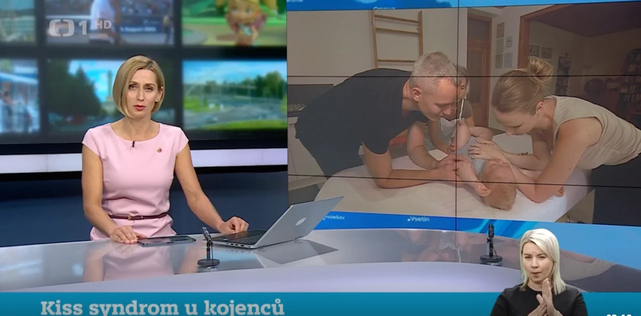 ČT Události v regionech Ostrava, KISS syndrom u kojenců